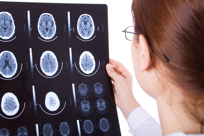 Female doctor examining a brain cat scan
